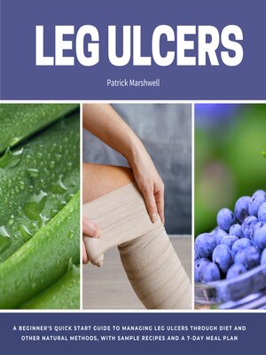 cover image of Leg Ulcers